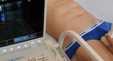 Diagnosis options for varicose veins of the lower extremities